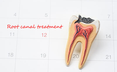Get Relief From An Infected Tooth With A Root Canal Treatment