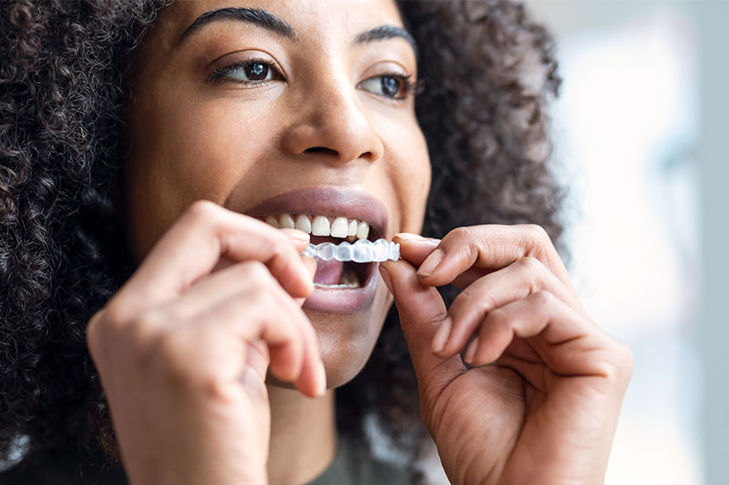 Clear Aligner Therapy in Henderson