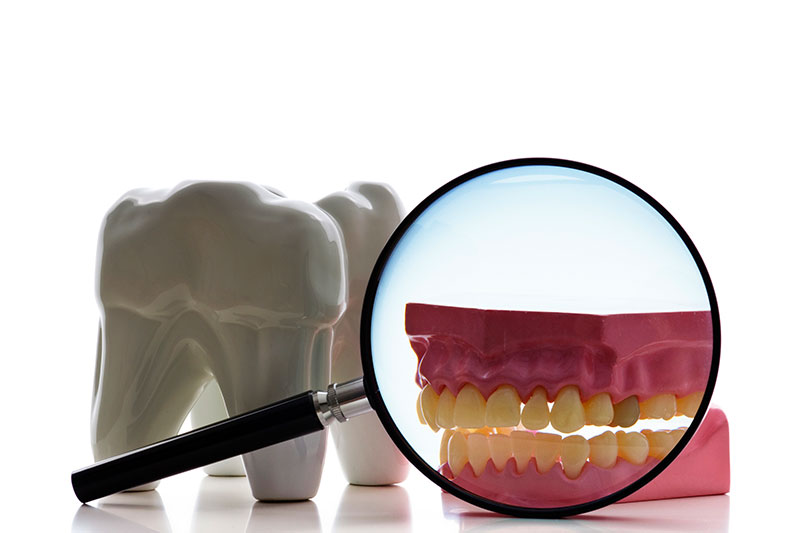 Root Canal Treatment in Henderson