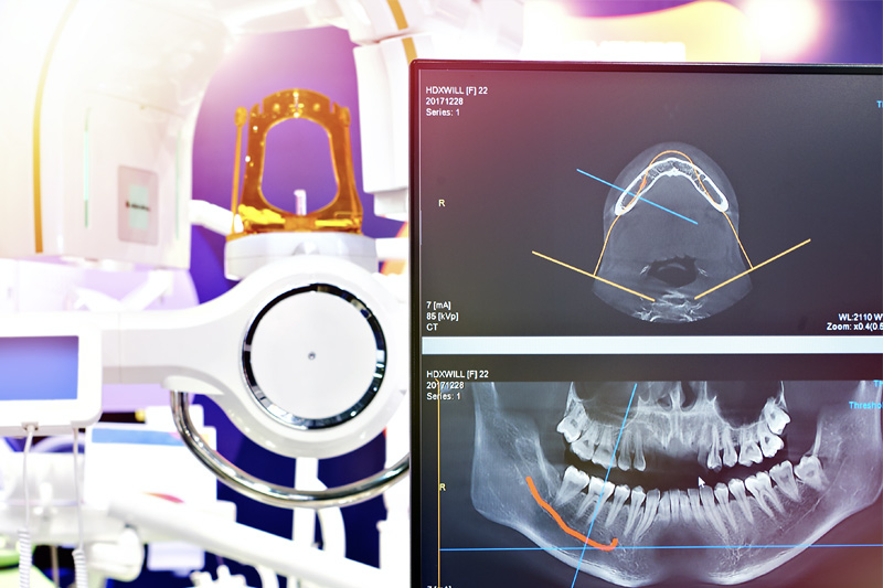 Digital X-Rays in Henderson