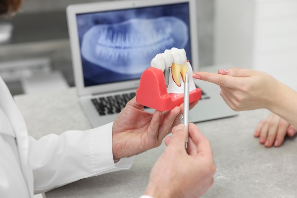 Foods You Should Avoid With Dental Implants