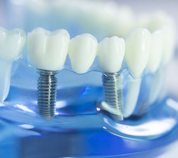 Henderson Dental Prosthetics