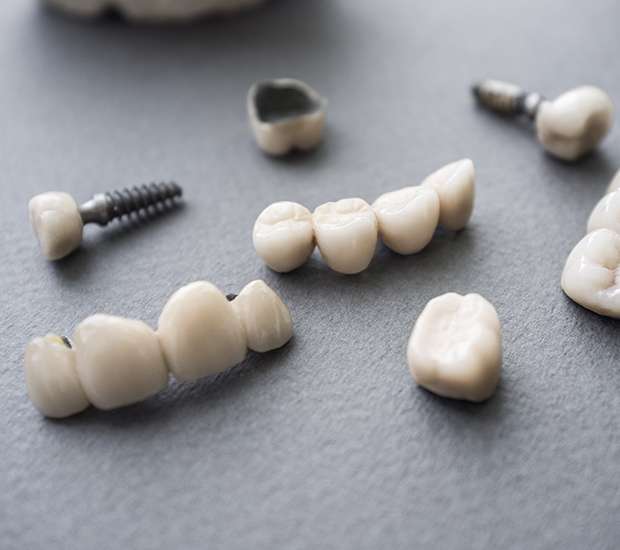 Henderson The Difference Between Dental Implants and Mini Dental Implants