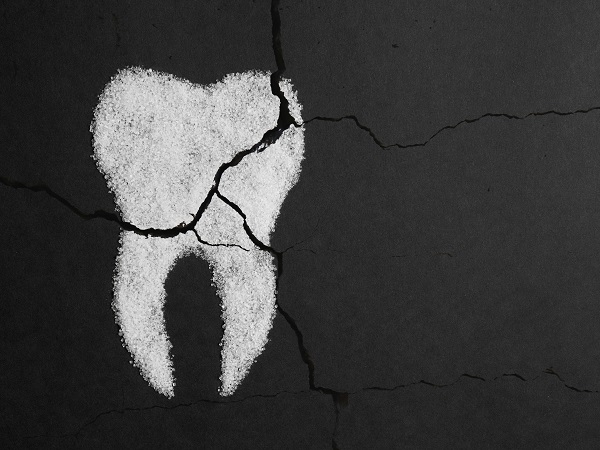 Tooth Decay Henderson, TX